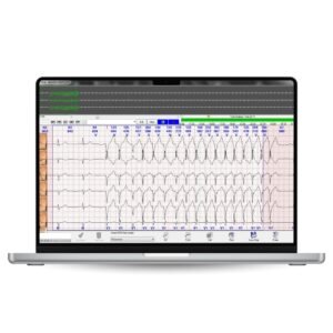 CardioScan 10