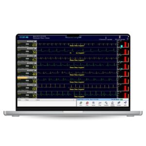 CardioScan Rehab