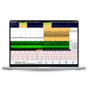 CardioScan 11